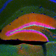 Illustration for article titled Human stem cells restore memory in animals with Alzheimer’s disease